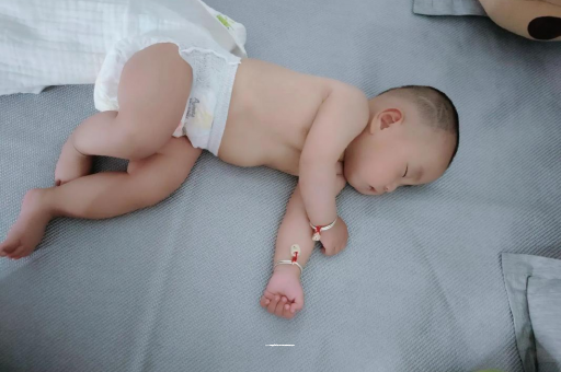简阳六个月宝宝眼睛散光
